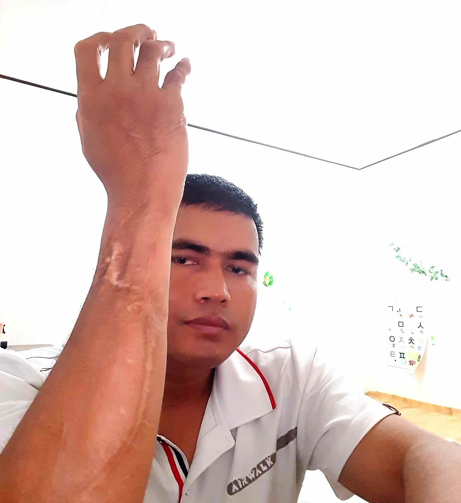 हाल कोरियामा रहेका घाइते ओलम्पियन तिलकराम